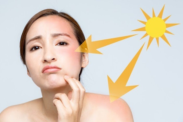 Bỏ ngay 5 thói quen xấu gây tổn thương nghiêm trọng cho làn da