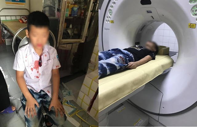 Vụ người đàn ông đánh học sinh lớp 1: Hiệu trưởng nhà trường lên tiếng