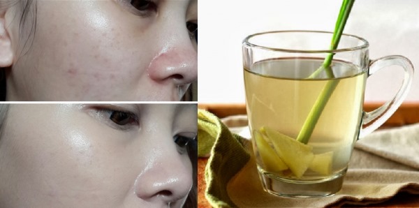 Da trắng mịn như gái Hàn nhờ xông mặt theo cách này Da trắng mịn như gái Hàn nhờ xông mặt theo cách này