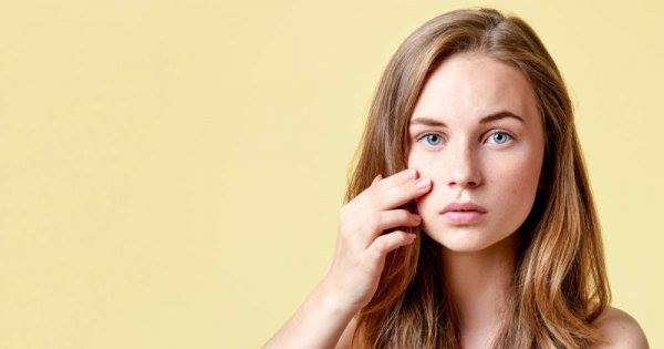 Ngày nắng nóng ăn gì giảm mụn trứng cá?