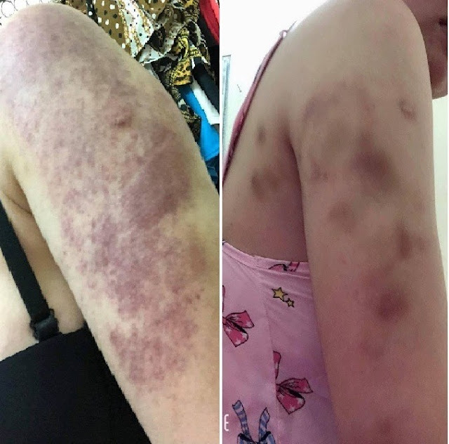 Loạt ‘bê bối’ của thẩm mỹ Nevada, Hasu và Kiyomi Beauty, bí ẩn đại gia Nguyễn Văn Thanh