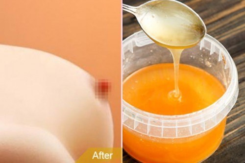 Dùng hỗn hợp này mỗi tối để nhũ hoa hồng hào chỉ sau 1 tuần