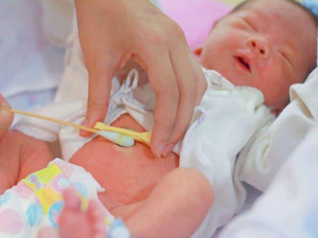 Lưu ý với bố mẹ cách vệ sinh rốn cho trẻ để dây rốn rụng tự nhiên nhất